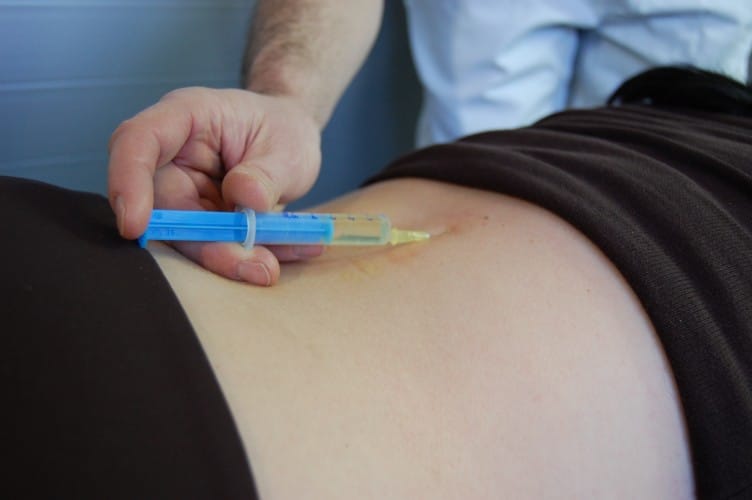 A doctor injects medicine into a patients back, for article caudal epidural injection