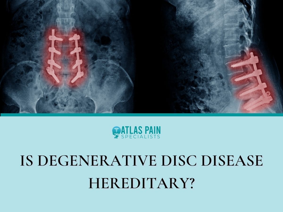 Degenerative Disc Disease - Everything You Need to Know 