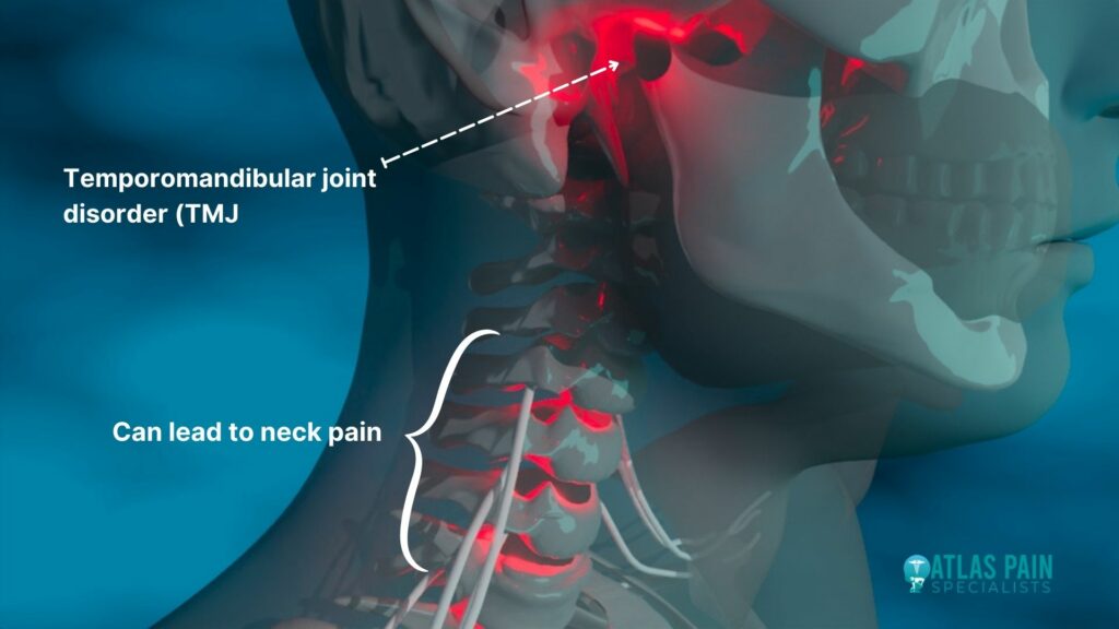 TMD pain, Different Types of Neck Pain