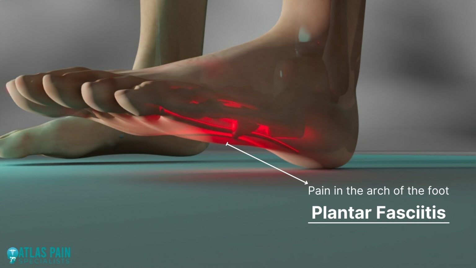 Could What You're Eating Cause Your Foot Pain?