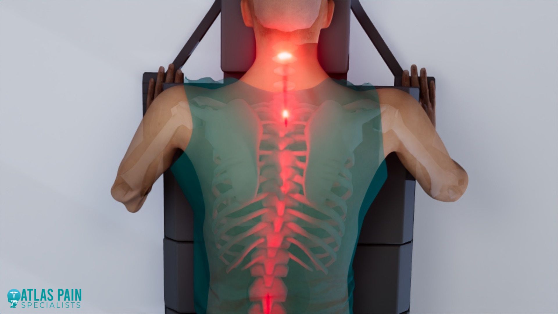 A misaligned spine for Neck Pain Worse After Chiropractor 