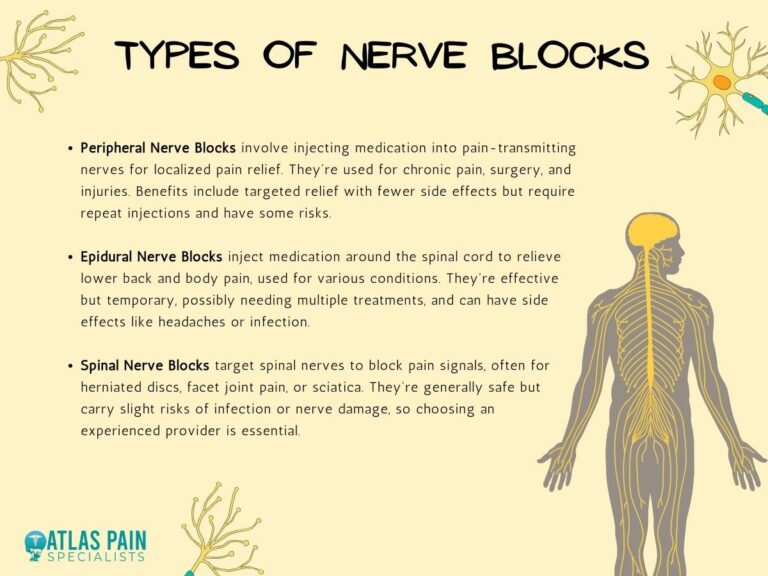 Nerve Blocks for Pain Management What You Need to Know Atlas Pain