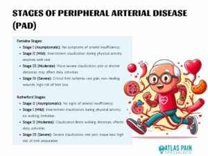 What is Peripheral Arterial Disease (PAD)? - Atlas Pain Specialists