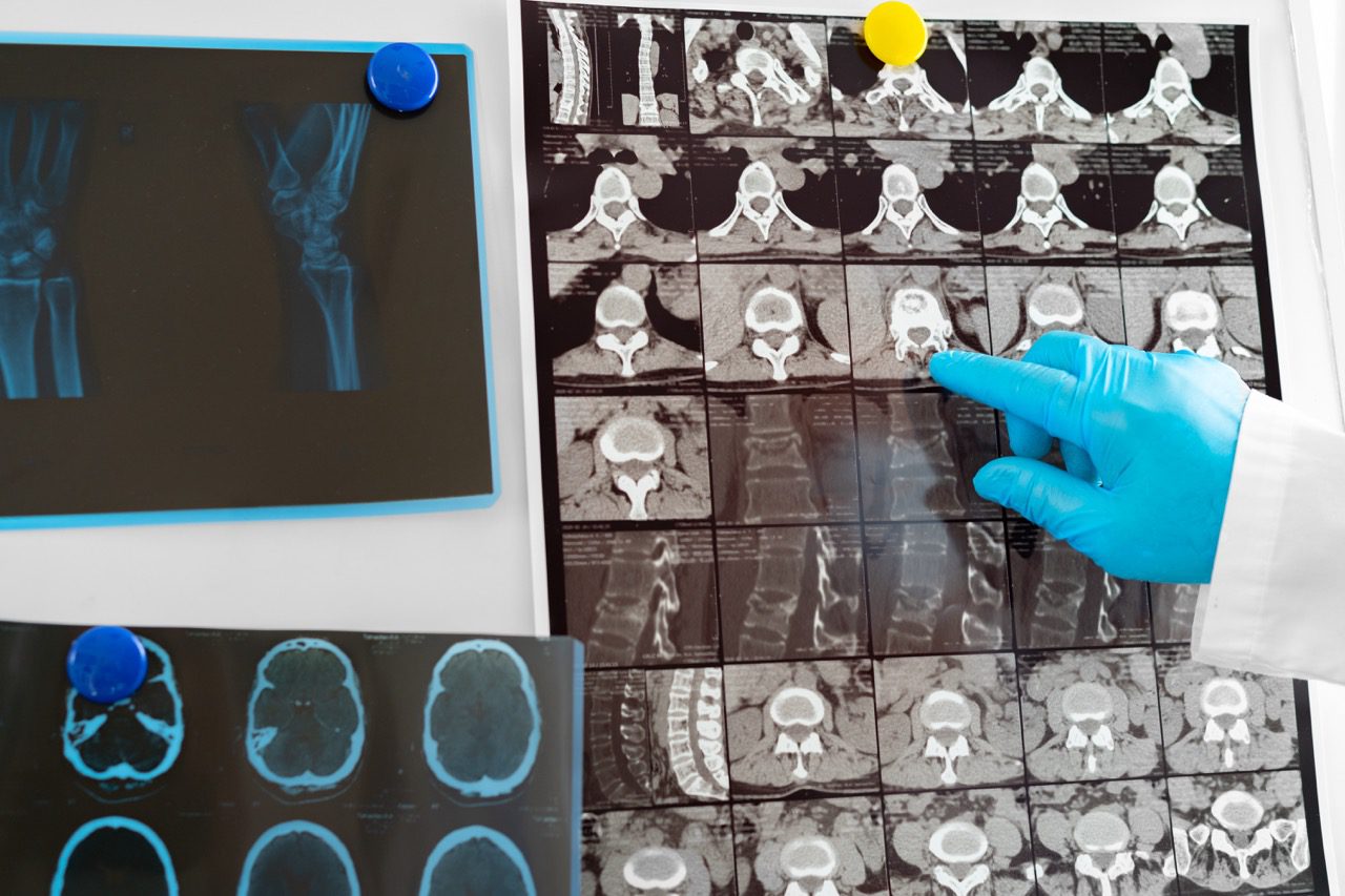 mri scan review